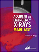 accident-and-emergency-x-rays-made-easy-2e