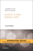 Chest X-ray Made Easy 4e