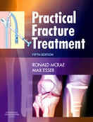 practical-fracture-treatment-5%d0%b5